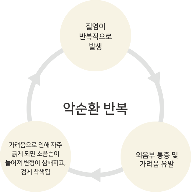 소음순 비대 방치 시 악순환 — 질염 반복·외음부 통증·가려움·변형·착색