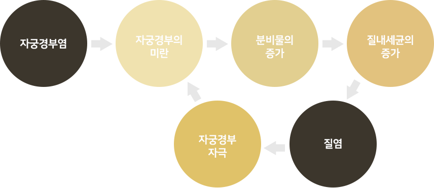 자궁경부염 악순환 — 자궁경부염 → 자궁경부의 미란 → 분비물의 증가 → 질내세균의 증가 → 질염 → 자궁경부 자극